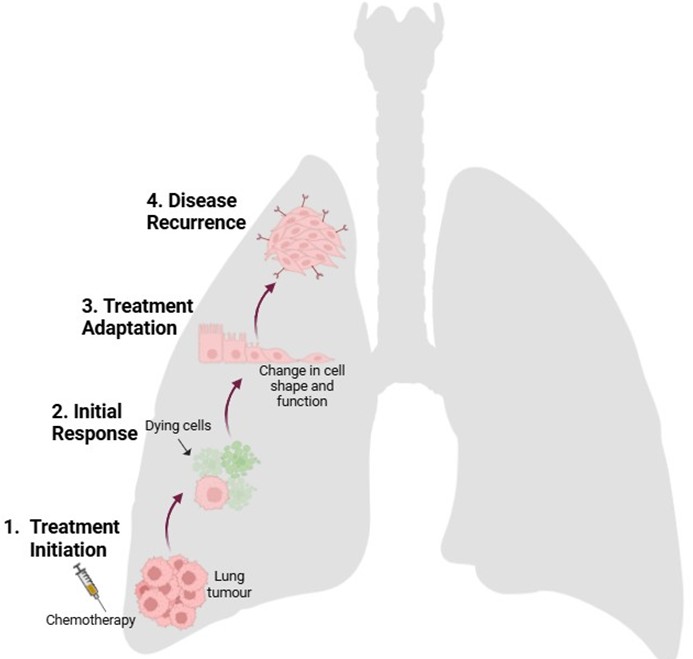 Diagram of chemotherapy resistance in lung cancer