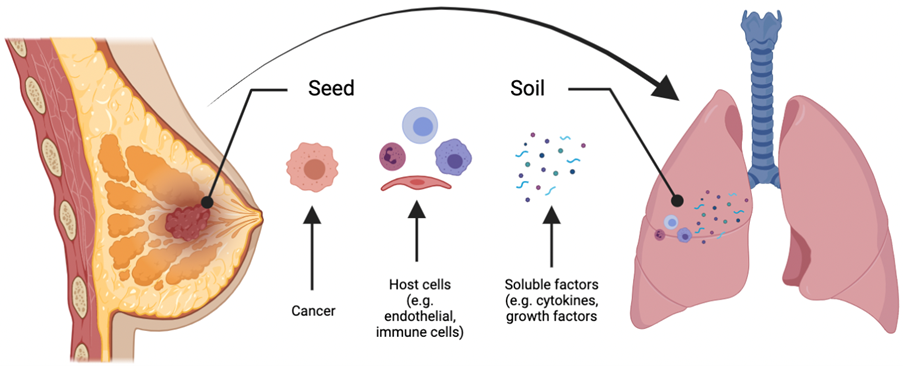 Diagram of cancer metastasis to lungs